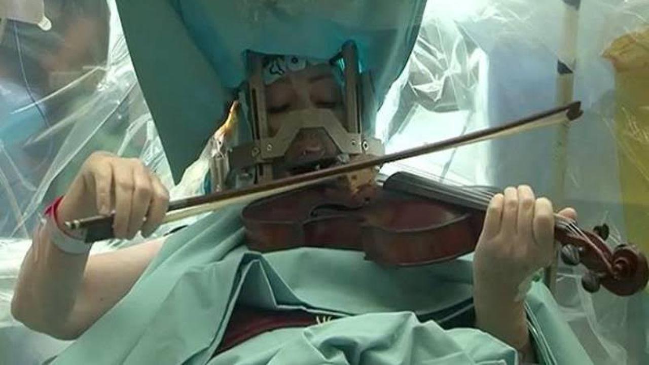 Operasi sambil main biola