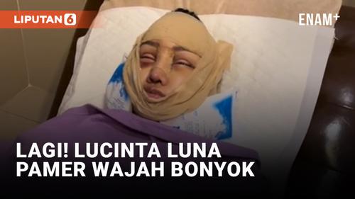 VIDEO: Lucinta Luna Pamerkan Wajah Bonyok Pasca Operasi Rahang dan Tulang Ekor