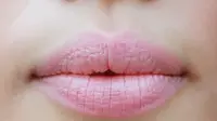 6 Solusi Bibir Pecah-pecah