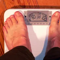 Kelebihan berat badan ekstrem pada obesitas tingkat 3 berbahaya bagi kesehatan. (Foto: geralt/Pixabay)