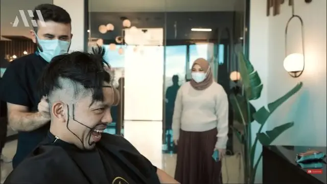 Akui Tak Percaya Diri, Ini 7 Potret Atta Halilintar Jalani Transplantasi Rambut