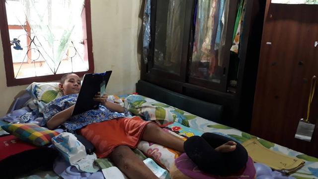 Aegis hanya bisa berbaring di kasurnya setelah beberapa bagian tubuhnya digerogoti sel kanker tulang (Liputan6.com / Nefri Inge)