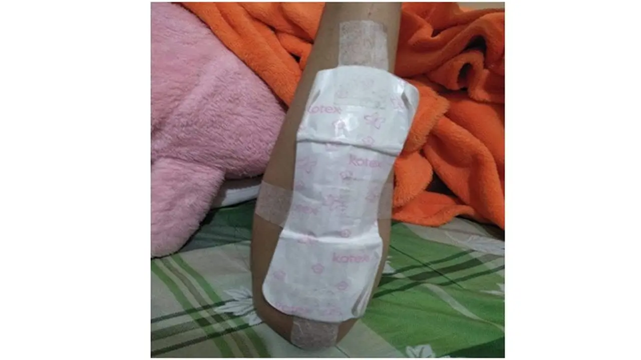 Pembalut untuk Tangani Luka