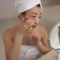 Yuk, simak rutinitas skincare yang ramah untuk kulit berjerawat. [Dok/freepik.com/pikisuperstar]