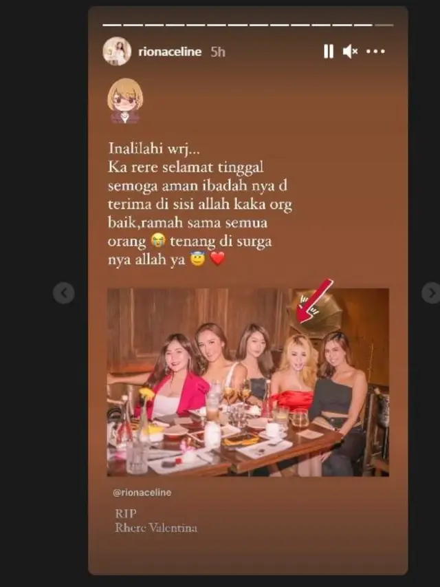 model dan artis Rhere Valentina meninggal dunia