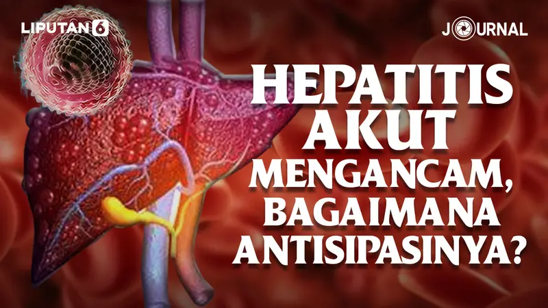 Hepatitis Akut Mengancam, Bagaimana Antisipasinya?