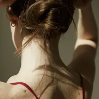 Ilustrasi jerawat punggung/https://www.pexels.com/Anna Nekrashevich