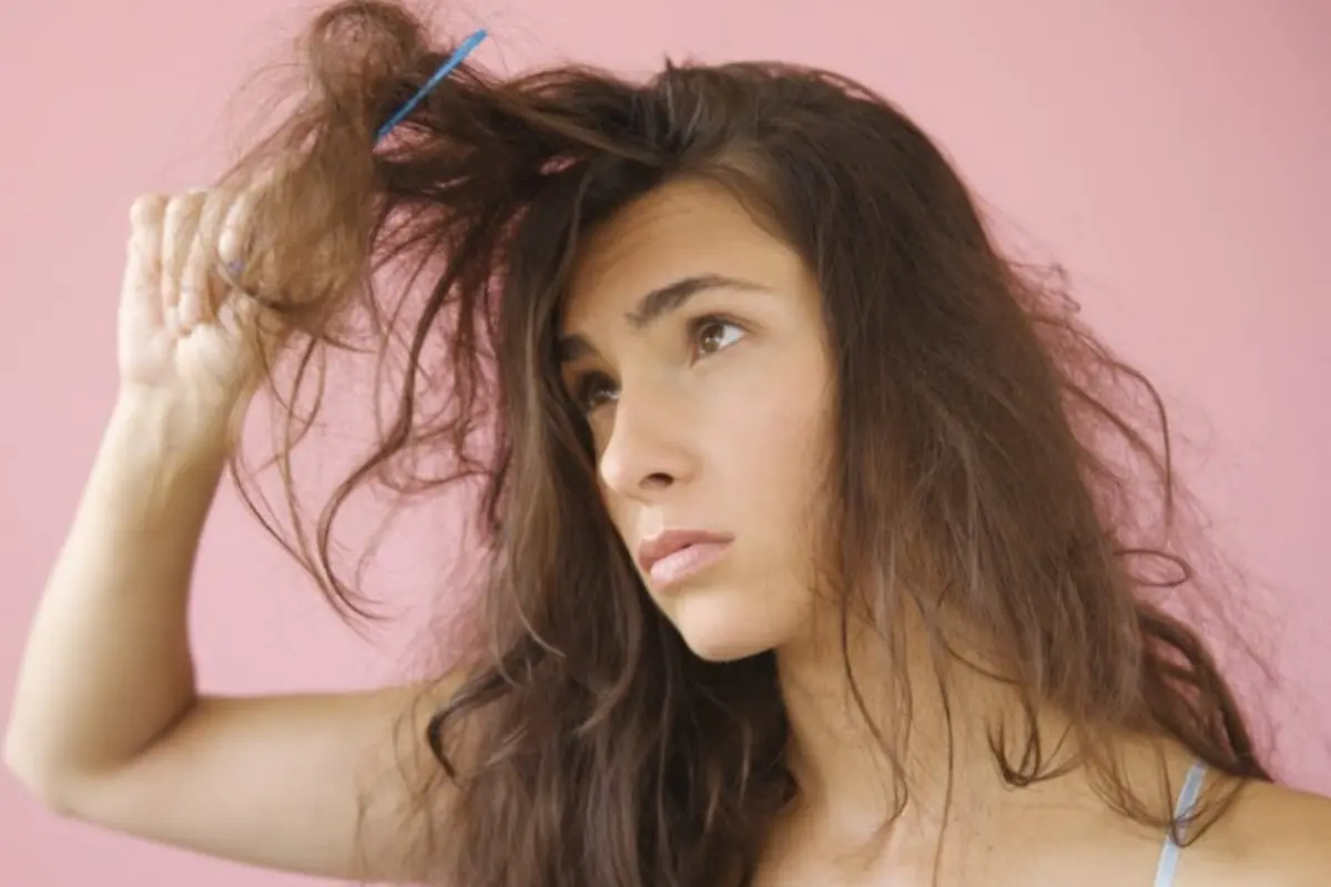 [Bintang] Kenali 3 Masalah Rambut yang Berkaitan dengan Kesehatan