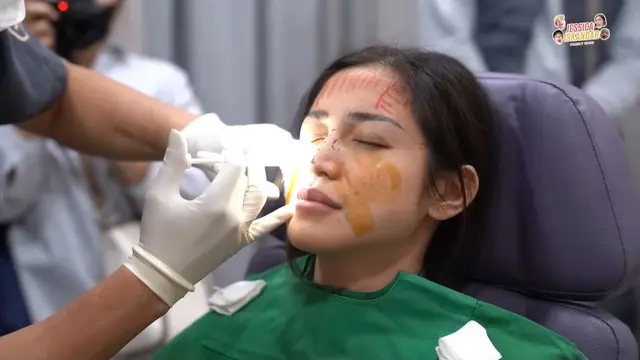 8 Potret Proses Jessica Iskandar Jalani Operasi Hidung di Korea, Bikin Pangling