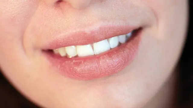 Bibir Kering, Jangan Dijilat!
