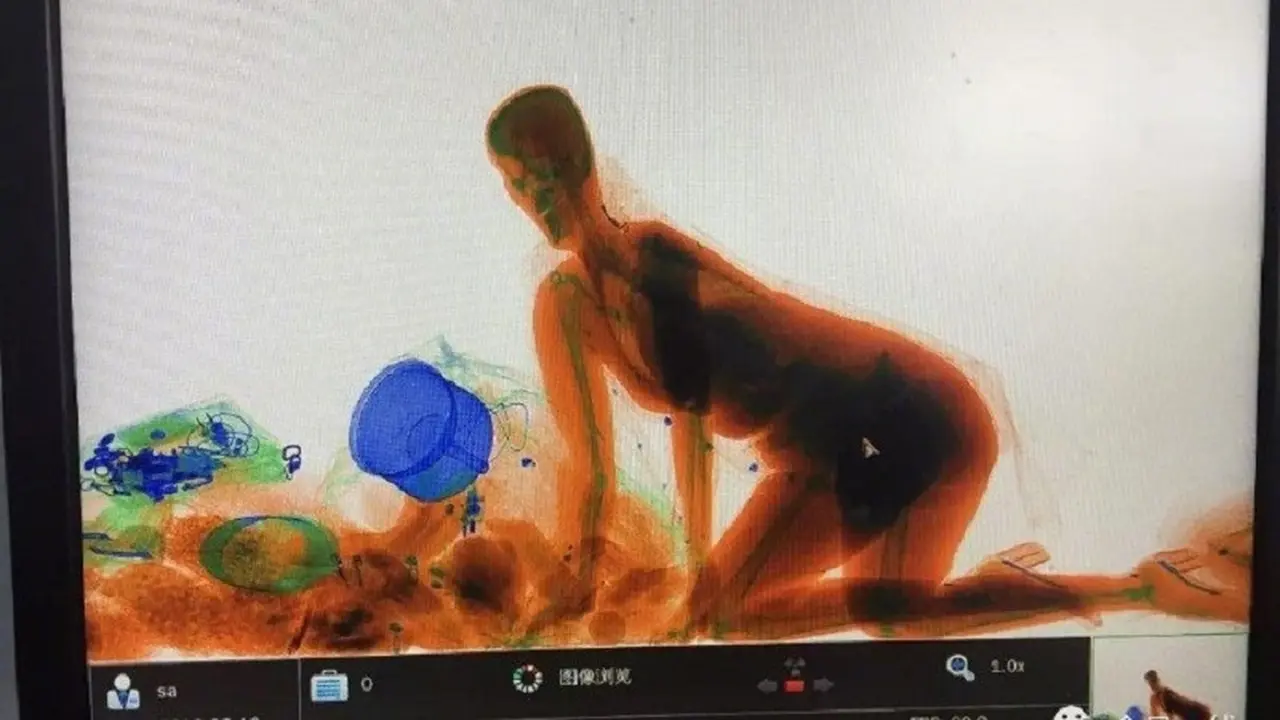 Kocak, Takut Tasnya Dicuri, Wanita Ini Masuk ke Mesin Sinar-X