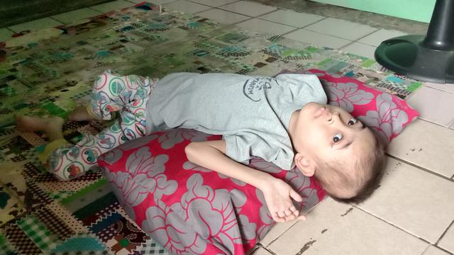 Anak sulung Herman dan Maiyah yang lumpuh sejak berusia 4 bulan