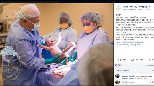 Ekspresi bayi Sullivan yang keren sesaat keluar rahim ibu. (facebook.com/LauraShockleyPhotography)