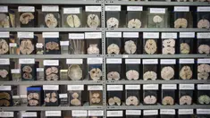 Koleksi otak manusia yang diawetkan di Museum Neuropatologi, di Rumah Sakit Santo Toribio de Mogrovejo, Lima, Peru (16/11). RS ini menyimpan sekitar 290 otak manusia yang dapat dilihat langsung sebagai bahan pembelajaran. (AFP Photo/Ernesto Benavides)
