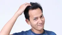 Cerita Fedi Nuril Tergiur Kacang Rebus Beraroma Obat Nyamuk