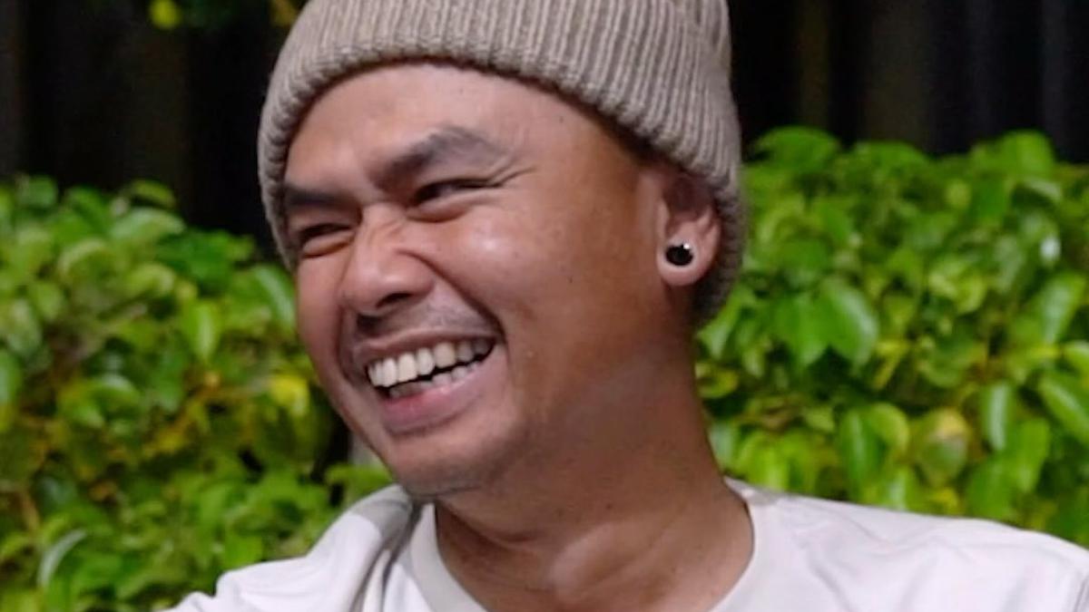 Wendi Cagur Jalani Transplantasi Rambut 5.000 Helai, Ngaku Deg-degan Saat Disuntik Anestesia