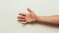 Cara Menghilangkan Mata Ikan di Tangan dengan Efektif dan Aman
