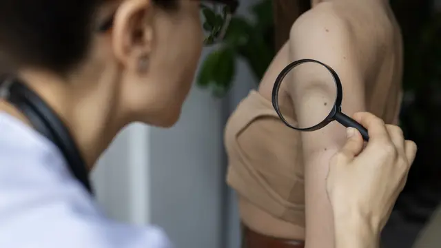 Seorang dokter sedang memeriksa permukaan kulit pasien menggunakan kaca pembesar (Foto Dok: Freepik/freepik)