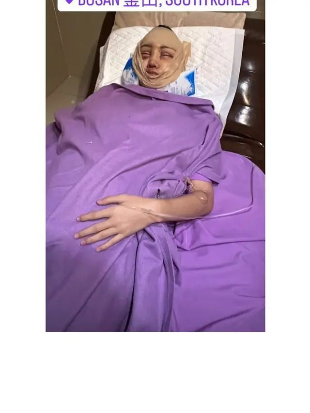 8 Potret Lucinta Luna Kembali Jalani Operasi Plastik, Curi Perhatian