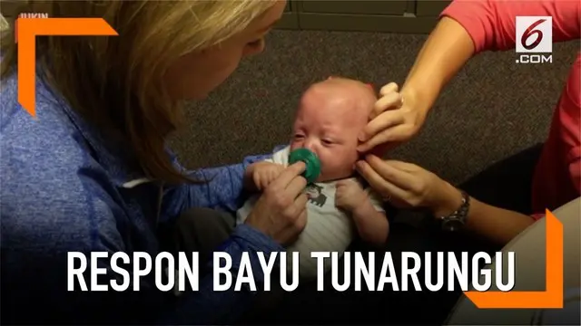 Seorang bayi yang terlahir tunarungu menunjukkan ekspresi lucu dan menggemaskan saat pertama kali mendengar suara.