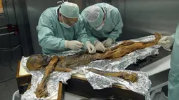 Ilmuwan memeriksa mumi Otzi di Museum Arkeolog EURAC, Bolzano, Italia, (4/1/2016). Ditemukannya struktur yang berbeda dari tubuh yang dimiliki manusia Otzi dan manusia modern. (REUTERS / Sudtiroler Archaeologiemuseum)