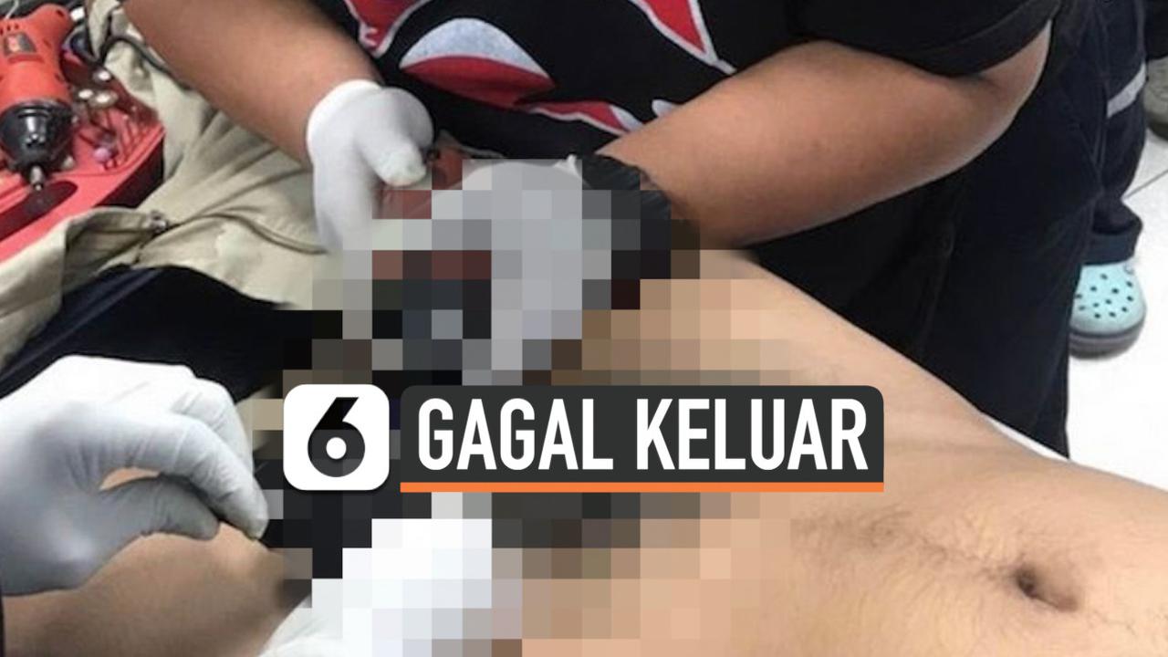 VIDEO: Tersangkut 5 Hari, Kemaluan Pria Ini Membengkak