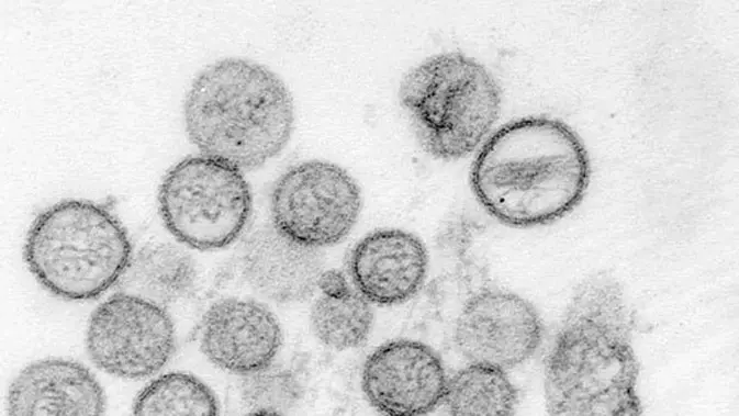 Ilustrasi virus hanta. (Source:AP)