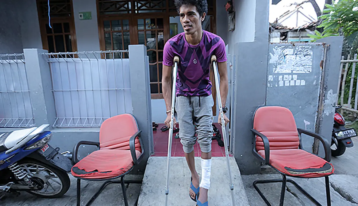 Alfi Tuasalamony rajin berlatih jalan untuk membantu proses penyembuhan cederanya. (Bola.com/Peksi Cahyo)