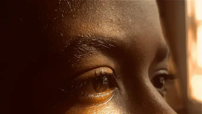 Cara Mengatasi Puffy Eyes Agar Terlihat Instan Awet Muda