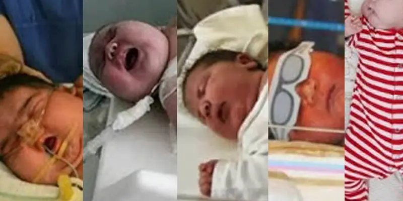 Ini 7 Bayi Raksasa di Berbagai Penjuru Dunia