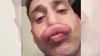 Pria ini ingin memiliki bibir seksi seperti Kylie Jenner (Foto: Mirror.co.uk)
