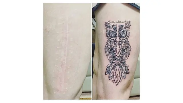 Wanita Ini Kreasikan Bekas Luka dengan Tato, 7 Hasilnya Mengagumkan