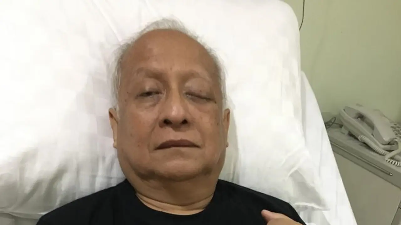 Errol Jonathans tutup usia di RS Mata Undaan Surabaya (Dian Kurniawan/Liputan6.com)