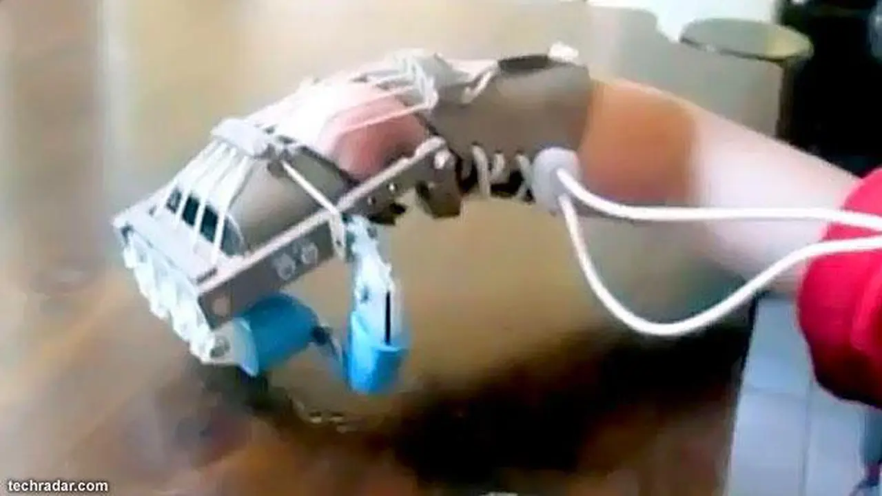Tangan Balita Ini Terbuat dari Printer 3D