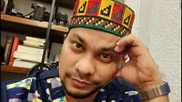 Ibunda Tompi Meninggal Dunia di Medan