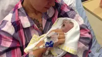Bayi Berumur 100 Menit Jadi Pendonor Organ Termuda