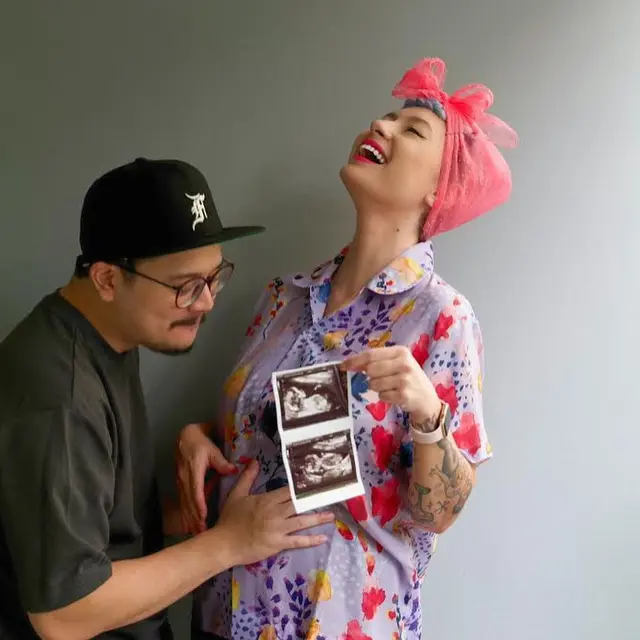 6 Potret Derby Romero Jadi Suami Siaga, Siap Sambut Kelahiran Anak Perempuan