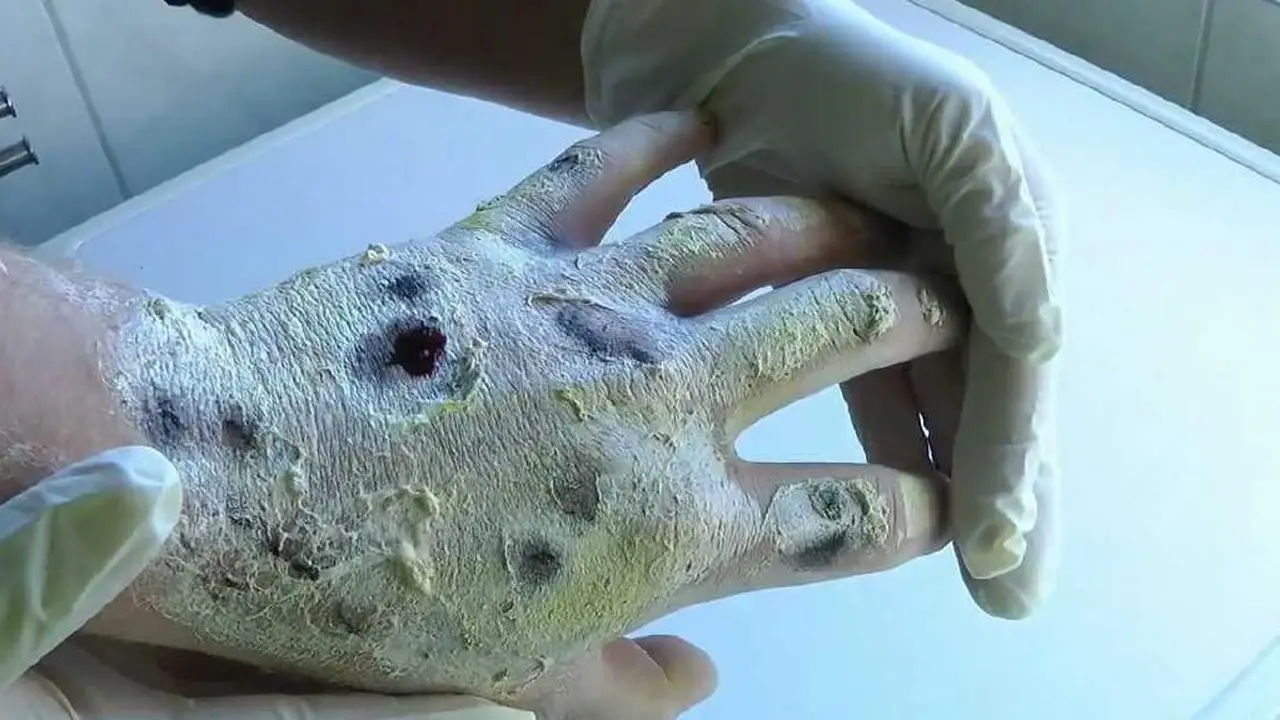 Zombi