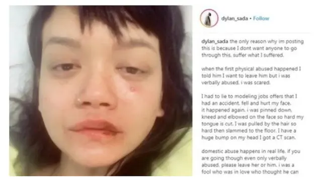Dylan Sada Meninggal Dunia, Ini 5 Fakta Sosoknya yang Pernah Jadi Korban Kekerasan