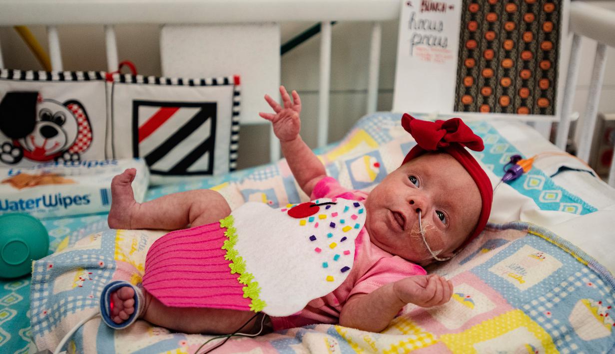 Charlotte Brewer, Athena yang berusia dua bulan mengenakan kostum cupcake saat menjalani perawatan di NICU sebuah rumah sakit di Texas, Rabu (30/10/2019). Pihak RS memakaikan kostum pada bayi-bayi prematur untuk merayakan Halloween pertama mereka. (Sarah A. Miller/Tyler Morning Telegraph via AP)