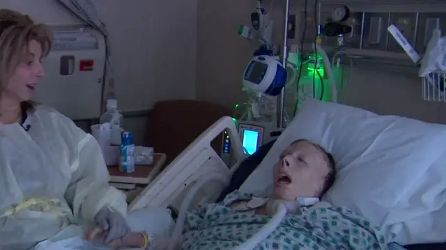 [Bintang] Karena Sang Mantan Pacar, Perempuan Ini Harus Menjalani 56 Kali Operasi