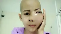 Sakit Gigi Dahsyat, Gadis Ini Ternyata Idap Kanker Tulang 