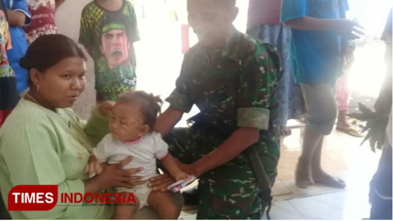 Balita di Probolinggo Luka Dicakar Kera Liar