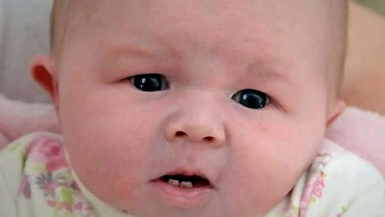 bayi-bergigi-131004b.jpg
