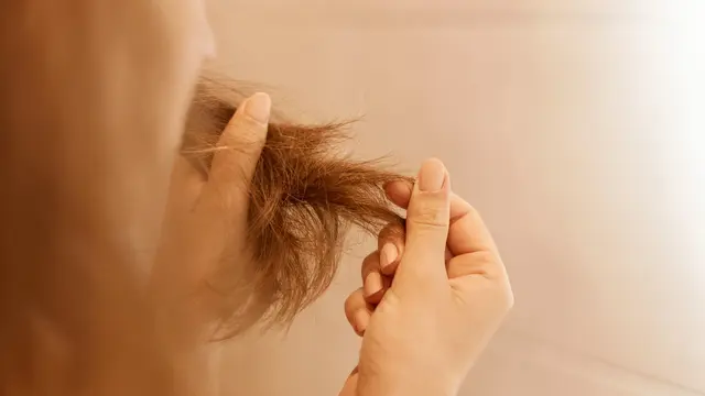 Bahan dan Obat untuk Mengatasi Rambut Rontok, dari Minoxidil hingga Biotin