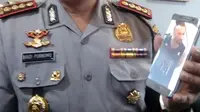 17 Luka di Jasad Polisi Kuta Bali