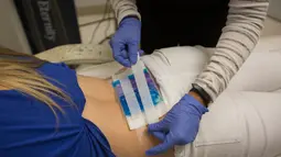 Perawat menempelkan cairan dingin dengan perban di atas pinggang Janica Polmanteer yang bertato di klinik Dr. Tatoff, California, Rabu (11/5). Peningkatan tersebut diiringi dengan menggeliatnya bisnis penghapusan tato. (AFP PHOTO/DAVID McNew)