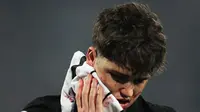 Muka bek Barcelona Pau Cubarsi penuh darah. (Pedja Milosavljevic / AFP)