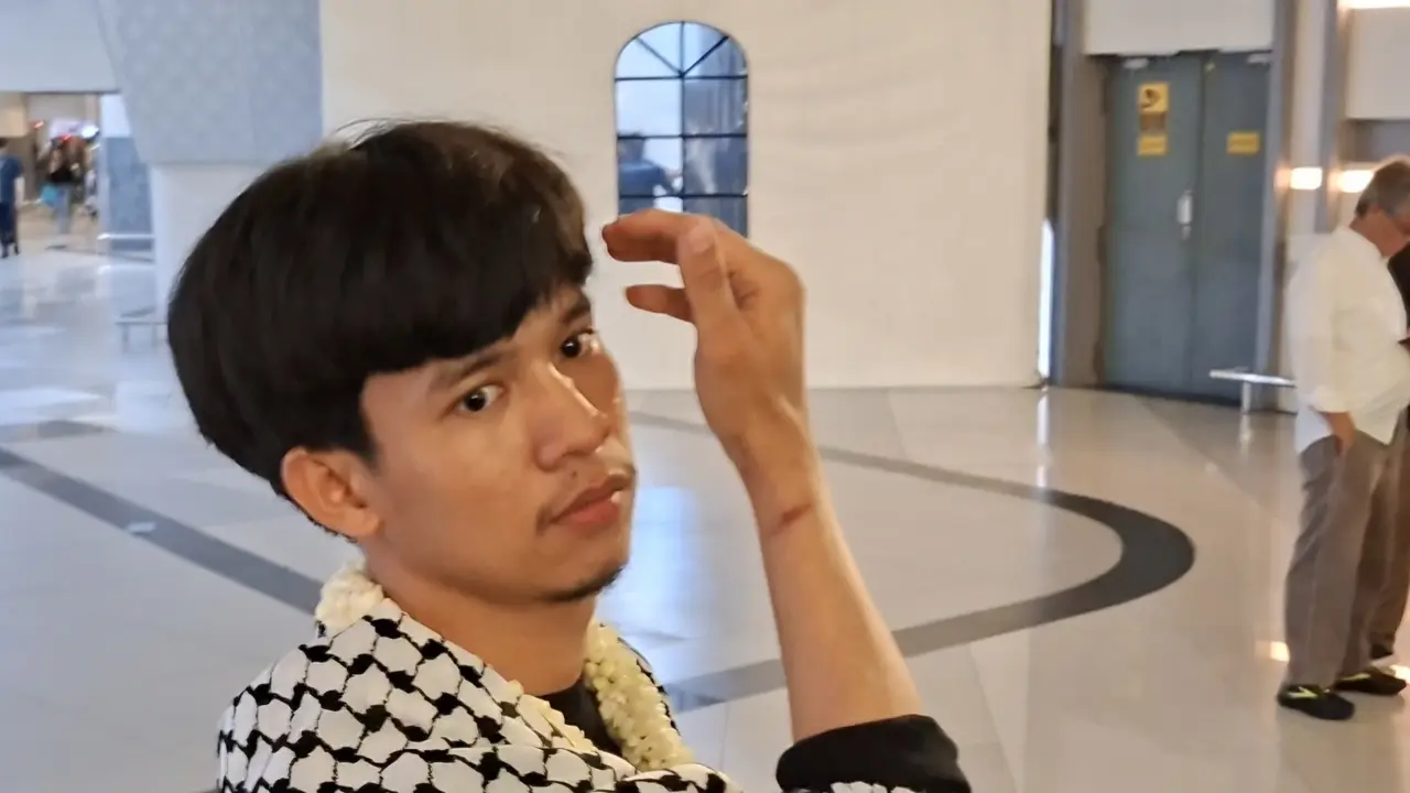 Bekas Borgol di Tangan Andre Jadi Saksi Misi Kemanusiaan ke Gaza