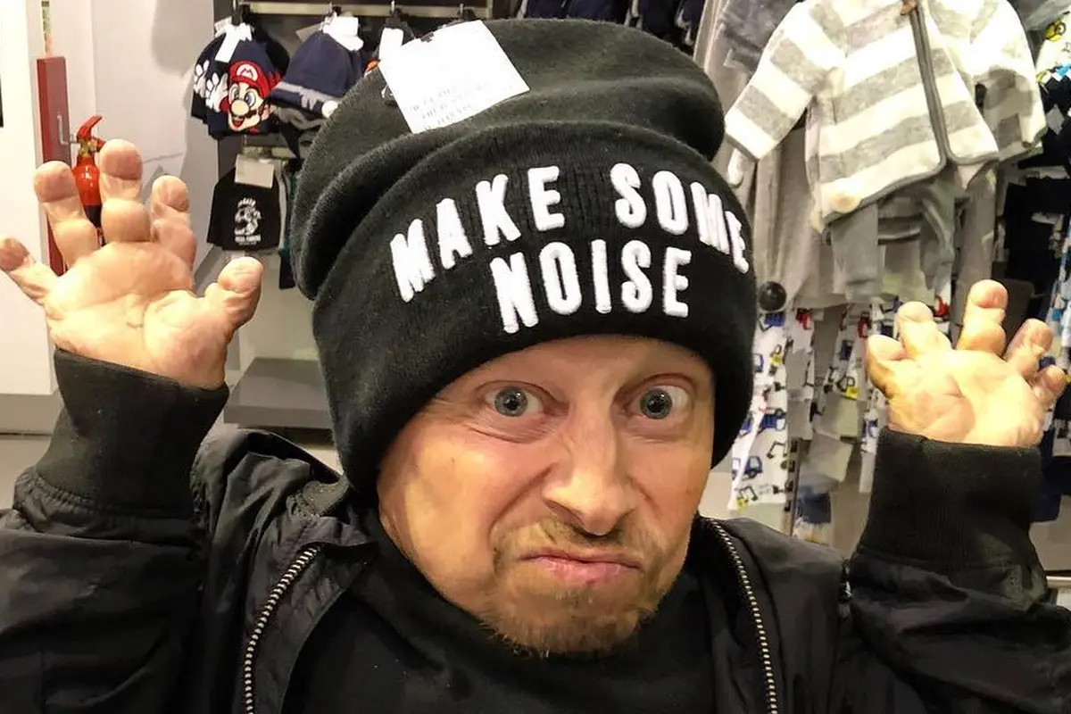 [Bintang] Pemeran Mini-Me di Austin Powers, Verne Troyer Meninggal Dunia
